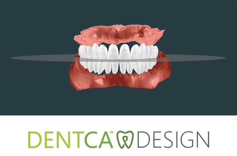 DENTCA